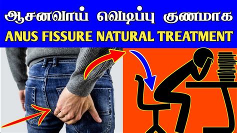 ஆசனவாய் வெடிப்பு குணமாக Anal Fissure Natural Treatment In Tamil Thanithuvamm Youtube