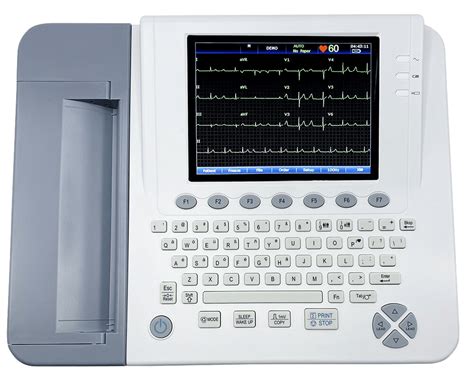 Buy The Edan SE 1200 Express Basic 12 Channel EKG At AKW Medical