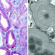 A) Trichrome stain (original magnification, × 400). (B) Electron ...