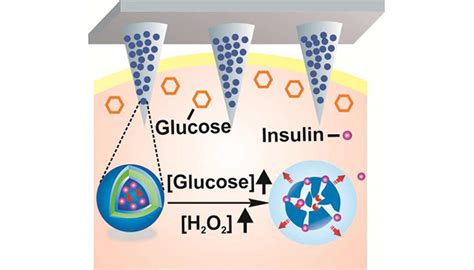 Researchers develop responsive, insulin-releasing skin patch - Drug ...