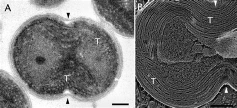 Thin Section A And Deep Etch Freeze Fracture B Of Dividing