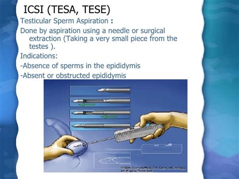 Assisted Reproductive Technology