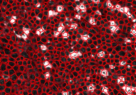 How the cell's `cell` and `membrane` measurement calculated for staining with high overlapped ...