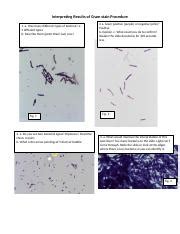 Tips for Interpreting Gram Stain Results: Bacterial Types, | Course Hero