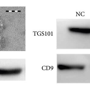 Expression Levels Of Plasma Exosomal Mir Mir And Mir In