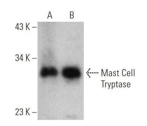 Mast Cell Tryptase Antibody (G3) | SCBT - Santa Cruz Biotechnology