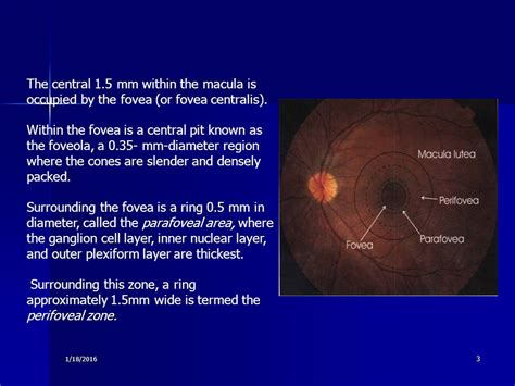 The Retinal Disorders 426 Ppt Video Online Download