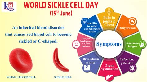 World Sickle Cell Day 2025 Theme Cissy Deloris