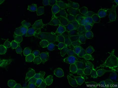 Beta 2 Microglobulin Antibody 68395 1 Ig Proteintech