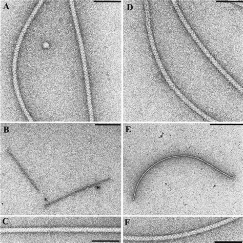 Electron Micrographs Of R Lupini And S Meliloti Wild Type And Mutant