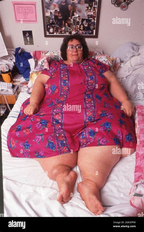 Killeen Texas USA 1993 Morbidly Obese Woman Weighing 600 Lbs