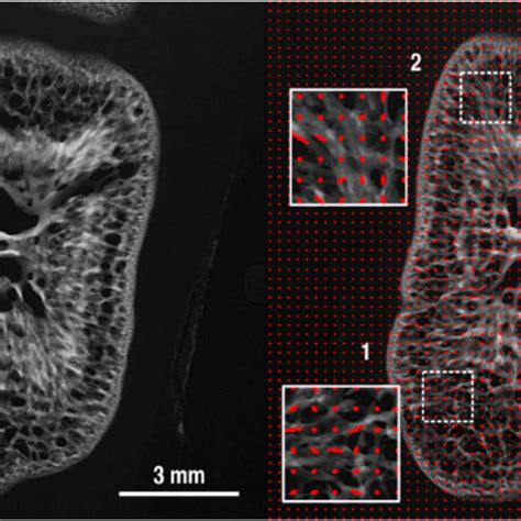 High-resolution bone radiographs and bone structure analysis. (a) X-ray... | Download Scientific ...