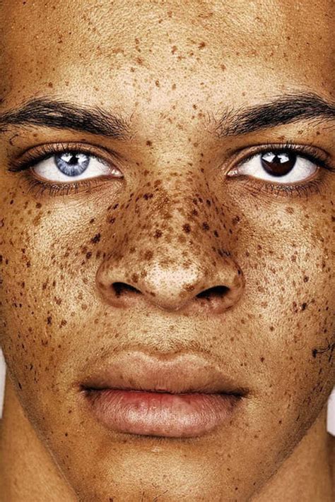 Amazing Portraits That Prove Freckles Are Beautiful