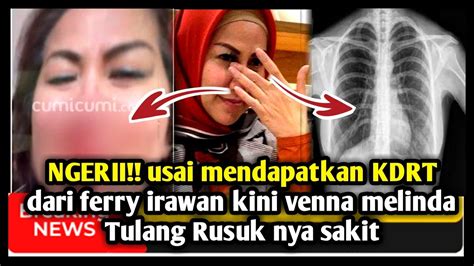 Berita Artis Venna Melinda Tulang Rusuk Nya Terasa Sakit KDRT YouTube