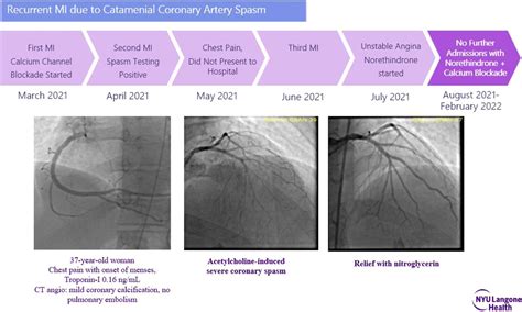 European Society Of Cardiology On Twitter 1 2 ESCardioEd Challenge