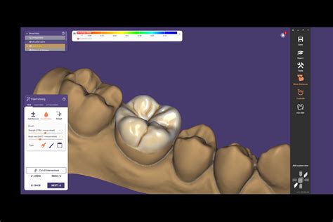 Chairsidecad Exocad Software Cad Dental Avanzado Techdent