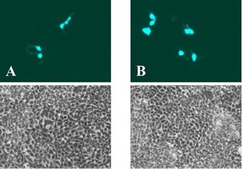 Pll Transduced T Cells Expressing Gfp Fluorescence Top