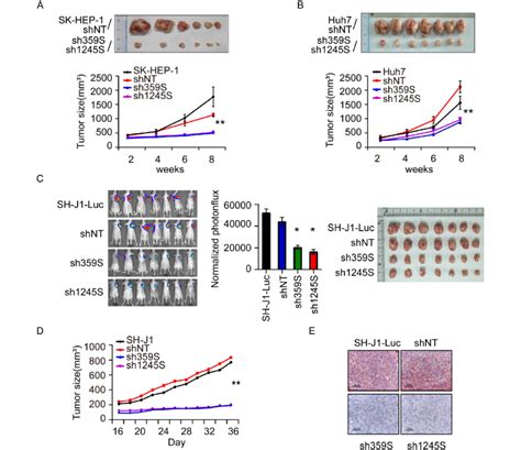 Psmd Knockdown Exerted Tumor Suppressive Effects On Hepatoma Carcinoma