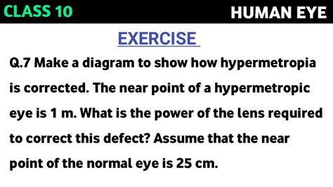 Make A Diagram To Show How Hypermetropia Is Corrected The Near Point