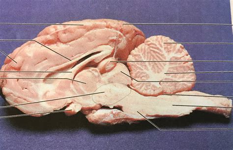 Sagittal Section Of Sheep Brain Diagram Quizlet