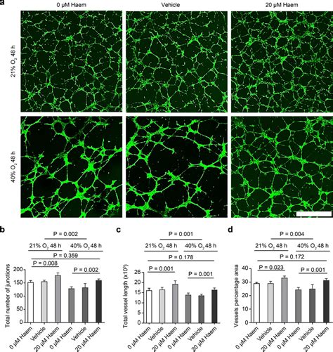 Effect Of Haem On The Angiogenesis Of HMEC 1 Cells A Images Of The