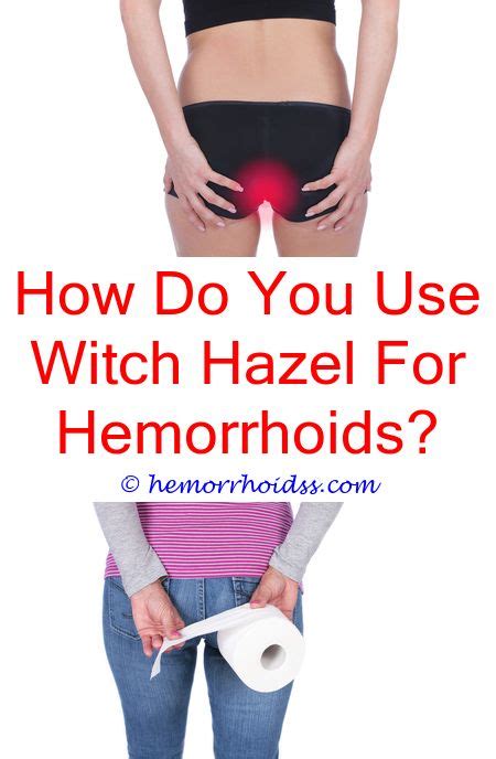 Do External Hemorrhoids Go Away On Their Own Do Hemorrhoids Actually