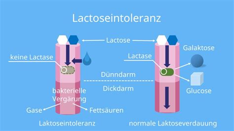 Lactose Milchzucker einfach erklärt mit Video