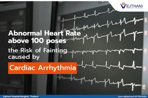 Abnormal Heart Rate Above 100 Poses The Risk Of Fainting Caused By Cardiac Arrhythmia Vejthani