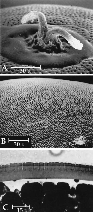 Scanning Electron Micrographs And Photomicro Graph Of Eggs Of L