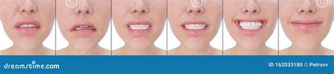 Set Female Facial Expressions Mouth Close Up Stock Illustration