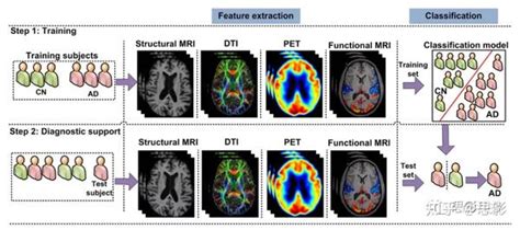 阿尔茨海默病及其先兆分期的神经影像分类研究及相关特征提取 知乎