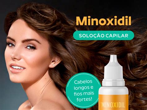 Minoxidil Nativa