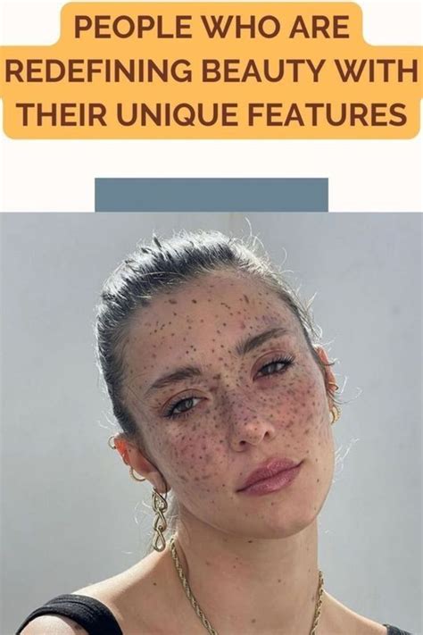 People Who Are Redefining Beauty With Their Unique Features Artofit