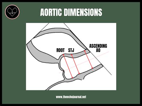 Parasternal Long Axis What To Acquire And How To Measure