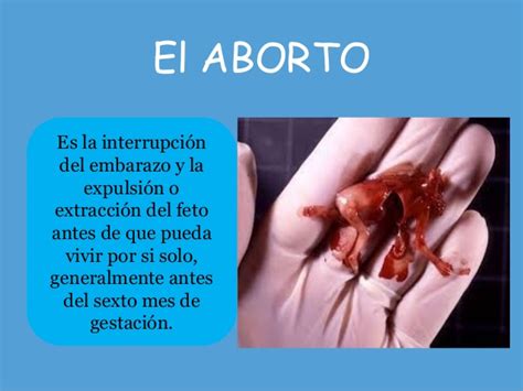 El Aborto