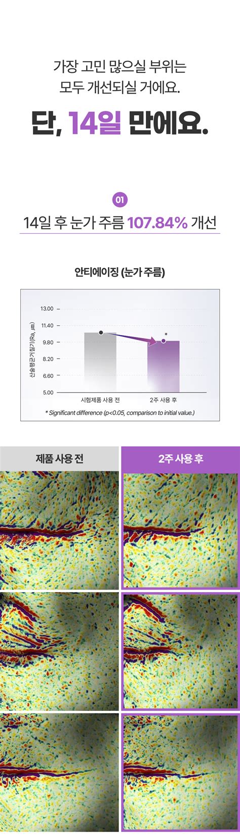 팔자주름 1266개선 안티에이징 임상 완료한 에이지스킨 세럼and크림