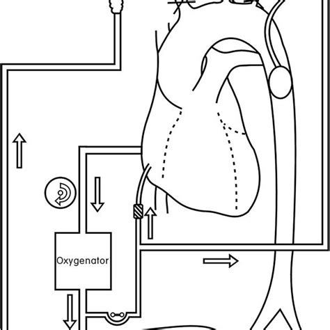 Cardiopulmonary bypass diagram. | Download Scientific Diagram