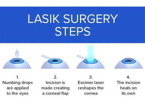 Laser Eye Surgery: Types, Cost, Side Effects, and Lasik Treatment Benefits