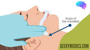 Basic Airway Management Flashcards Quizlet