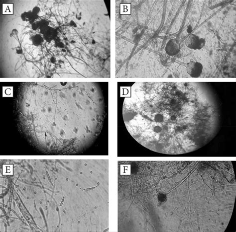 [A] Rhizopus spp., [B] Mucor spp., [C] Penicillium sp., [D] Aspergillus... | Download Scientific ...