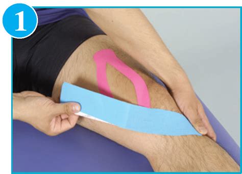 Chondromalacia Patella Kinesio