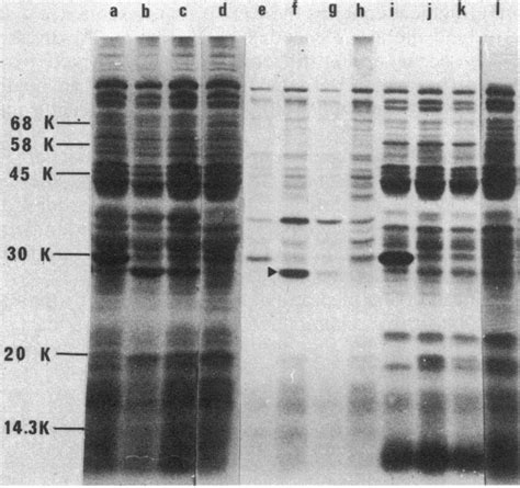 Autoradiogram Of L 35s Methionine Labeled Proteins Obtained After Uv