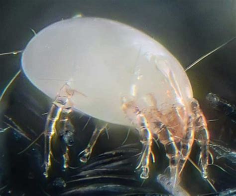 Dust mite bites, symptoms, treatment & pictures on Humans | Pestbugs