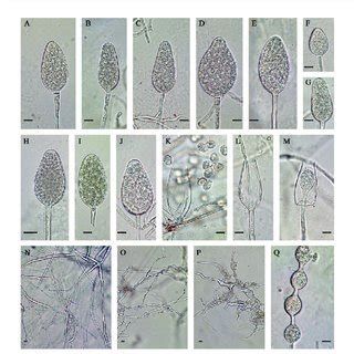 Colony Morphology Of Phytophthora Mississippiae Isolates On Various