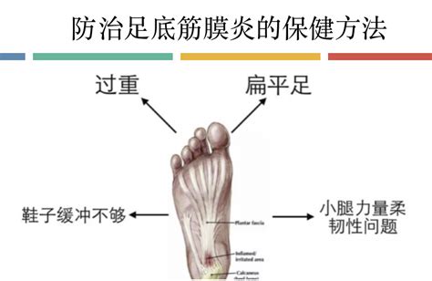 脚底酸痛的人必须看的，足底筋膜炎的保健方法 知乎