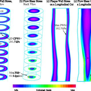 Overview Of 3D FSI Solution Behaviours Based On MR Images Of The Plaque