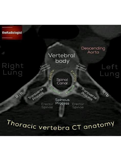 X-ray for Thorax | PDF