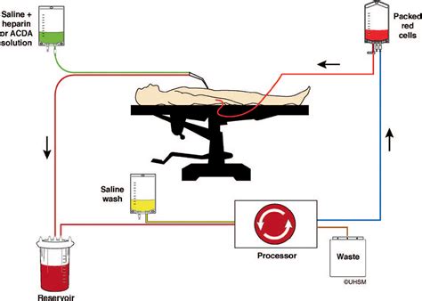 Blood Conservation Techniques Virtual Library