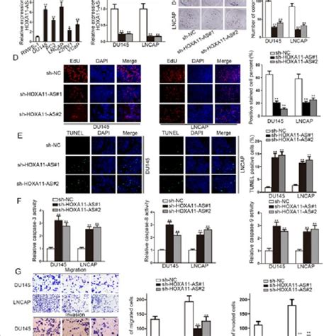 MLPH Is A Target Of MiR 148b 3p In Prostate Cancer Cells A The