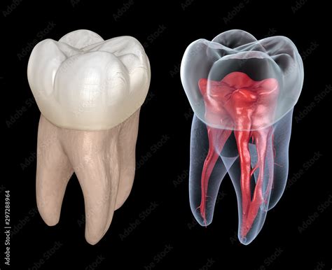 Molar Tooth D